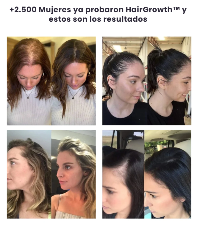 Hair Growth - Suplemento Avanzado para El Crecimiento Capilar.